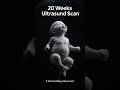 20 Weeks ultrasound Scan | 5 month baby development  #baby #fetusdevelopment #fetus #growth #womb