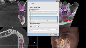 Exporting Objects from Planmeca Romexis