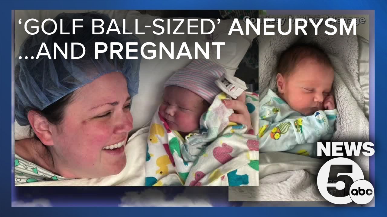 Mom undergoes brain aneurysm surgery while pregnant YouTube