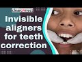 How invisible aligners are placed  clear correct  happy smiles dental care