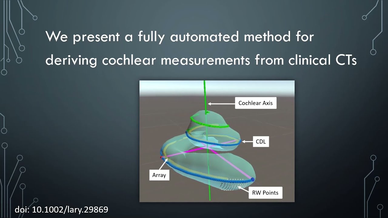 Automated measurement of the Cochlear duct length