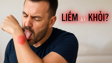 Sốc: Nước Bọt Giảm Sưng Viêm – Nhưng Đừng Vội Làm Theo!