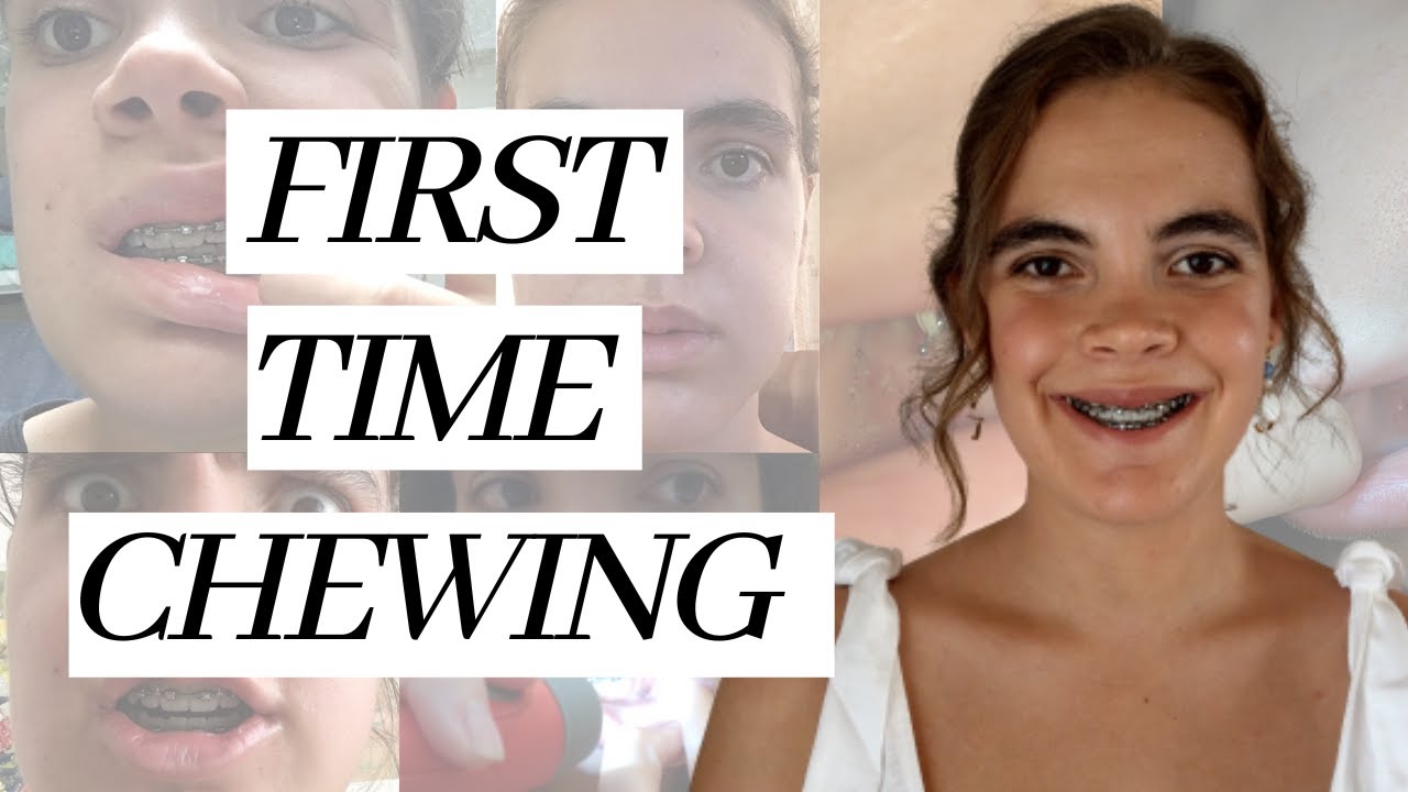 Double Jaw Surgery Recovery Eating solid food one month post operation