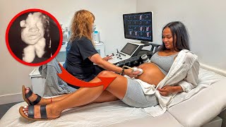 Seeing our Sons FACE for the First Time! **Emotional** (5D Ultrasound)