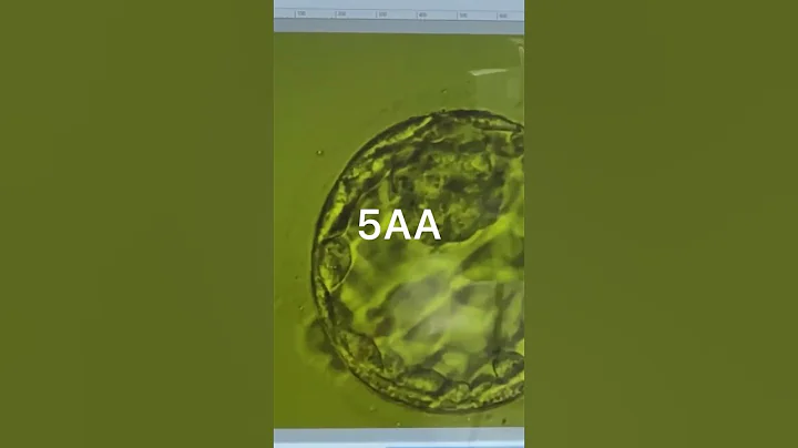 The Shocking Truth About Implantable Blastocyst 5AA #infertility #blastocyst #embryo #ivf #icsi