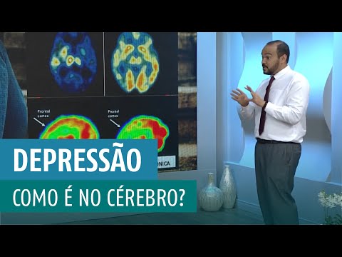 Vídeo: O que significa f alta de cérebro?