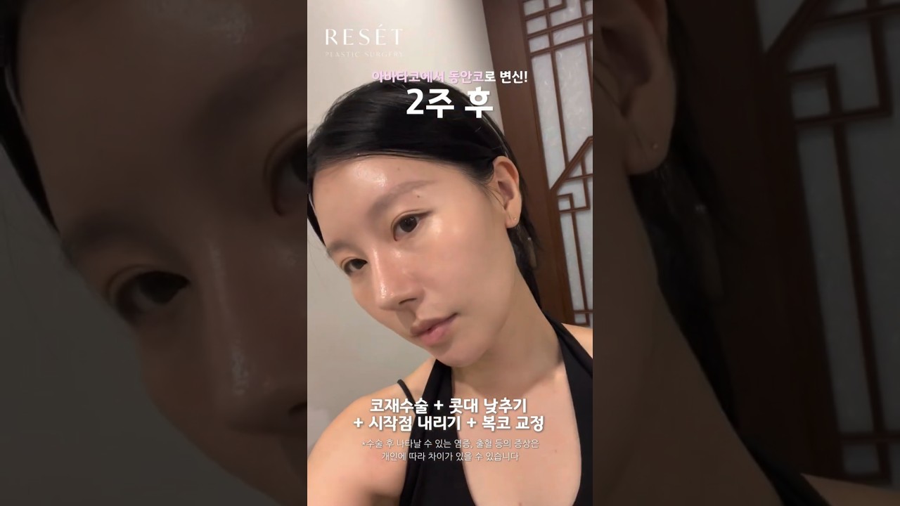 등록한썸네일
