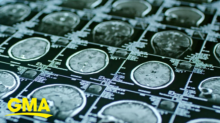 More than 100 people from New Jersey high school diagnosed with brain tumors l GMA