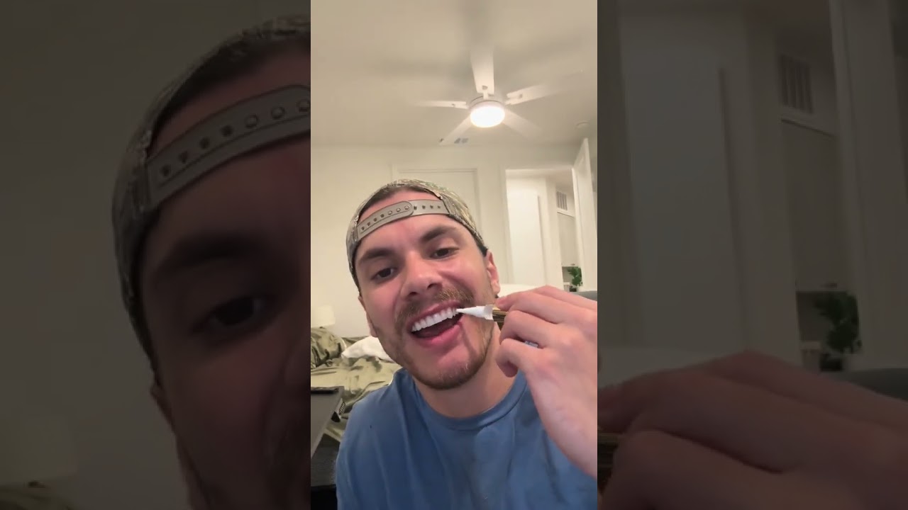 The Snow Gold Wand Whitening Serum is a targeted brightening serum that goes where strips can’t