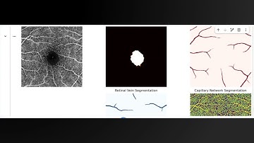 Visualization and Demo of the Proposed Model (VasFAZ-Net)