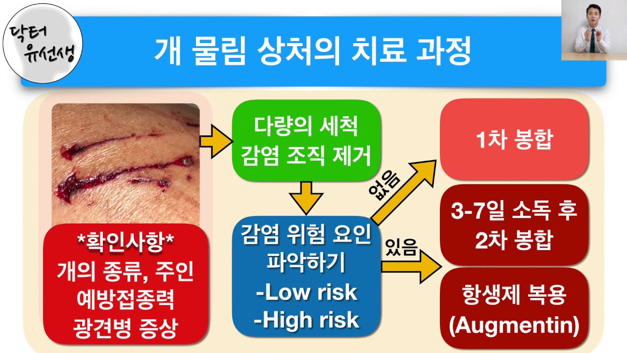 개에게 물린 후 얼마 후에 파상풍 주사를 맞아야 하나요