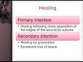 Healing of Oral Wounds Biospy primary secondary intention
