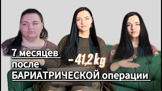 Сделала БАРИАТРИЧЕСКУЮ операцию и похудела на 41,2 кг/ Резекция желудка, Шунтирование желудка