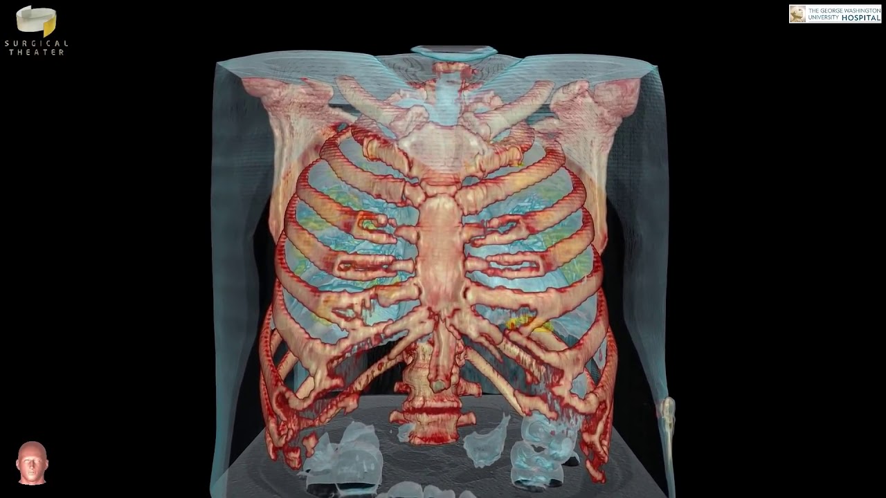 How Coronavirus Attacks the Body 