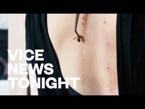 Video: Injekce Včelího Jedu, Pijavice, Mikroihly A Další Oblíbená Ošetření Hollywoodských Hvězd