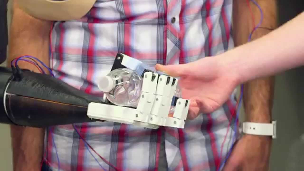 Idées à vendre : la main bionique