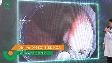 5 bước nội soi MCU cắt polyp tiền ung thư chiếm trọn chu vi lòng đại tràng