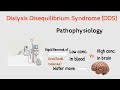 What is dialysis disequilibrium syndrome dds  hemodialysis complications and management