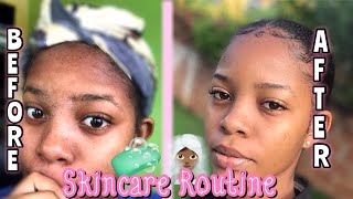 Skincare Routine (For Eczema-prone, hyperpigmented, dry skin) | 4 Easy Steps to Clearer Skin screenshot 5