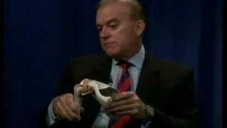 Dr. Torpey Part 1  Shoulder: Anatomy
