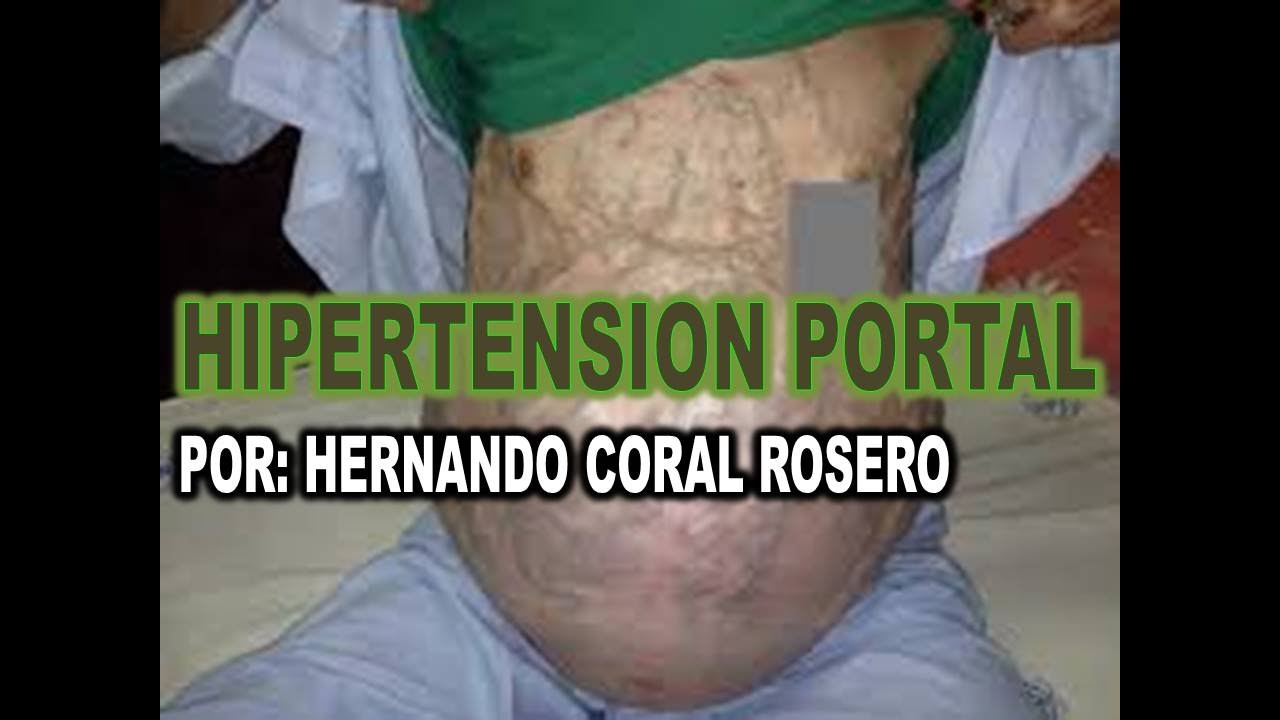 Colaterales perisplénicas hipertensión portal