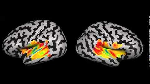 fMRI animation: Cochleotopic mapping of human auditory cortical fields