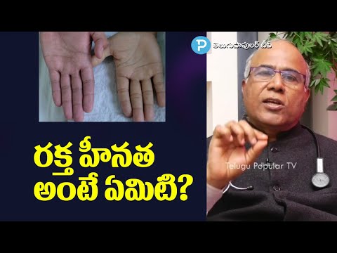 రక్త హీనత అంటే ఏమిటి?  Anemia: Causes, Symptoms, Diagnosis, Treatments | Dr.C.L.Venkat Rao