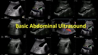 1- ABC Abdominal Ultrasound - Ahmed Morad