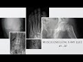 Musculoskeletal X-ray Quiz #1 - 30