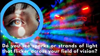 Flashing Lights In Field Of Vision - EXPLAINED! | Dr. D'Orio Eyecare