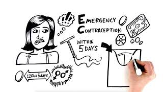Emergency Contraception: Birth Control 101