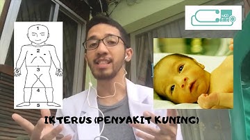 IKTERUS (PENYAKIT KUNING) | Video Edukasi Kesehatan 4