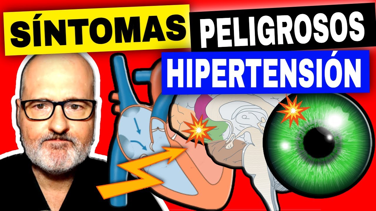 7 SÍNTOMAS PELIGROSOS en HIPERTENSOS (PRESIÓN ALTA URGENTE)