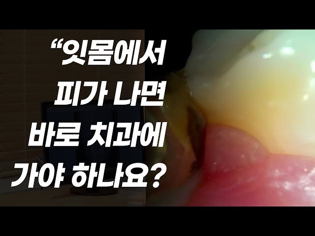 양치를 하다가 잇몸에서 피가나면 바로 치과에 가야할까?