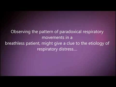 Video: Paradoks Pulsusa: Definicija, Astma In Drugi Vzroki, Merjenje