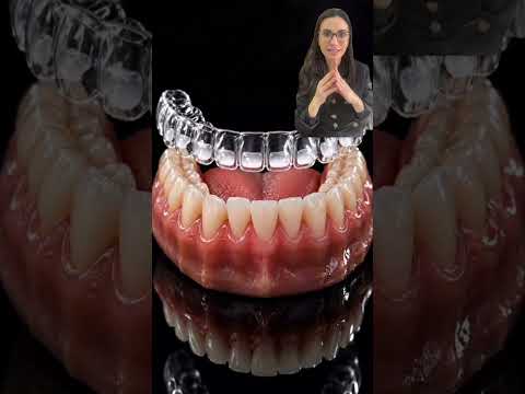 Corrigir sua mordida com placas transparentes ( alinhadores invisíveis)