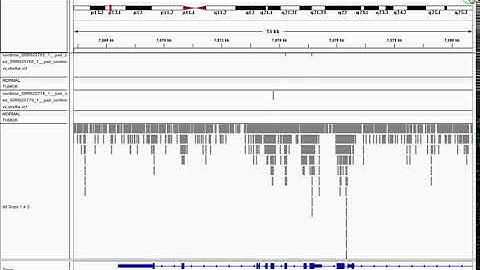 Genomics 1 IGV Annotation Example
