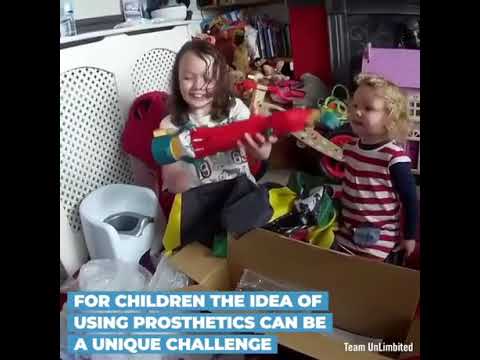 3d-printed-prosthetics-for-kids