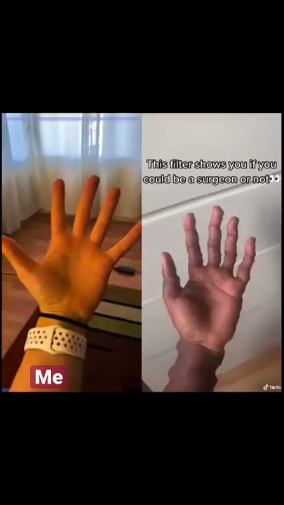 Real doctor tries viral TikTok surgeon challenge
