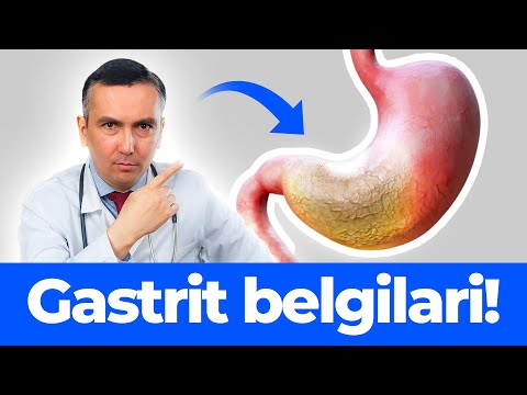 Video: Gastrit belgilari: belgilari va davolash