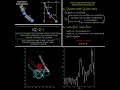 Dynamic Modeling and Simulation of a Double Spring Pendulum MATLAB #coding #robot #simulink #matlab