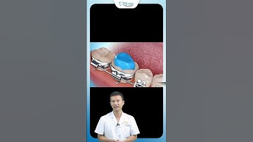 Nâng Khớp Trong Chỉnh Nha | Bác Sĩ Yên