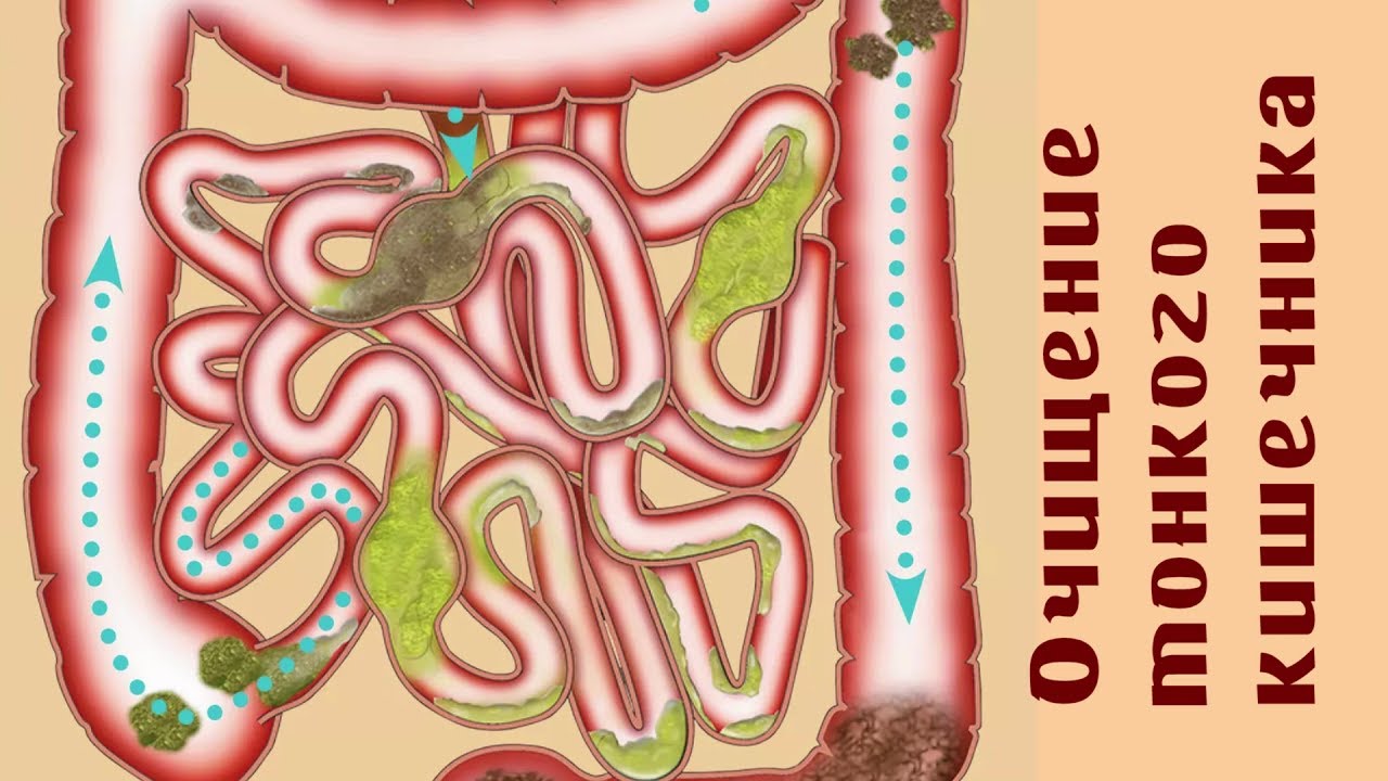 Можно ли очищать кишечник