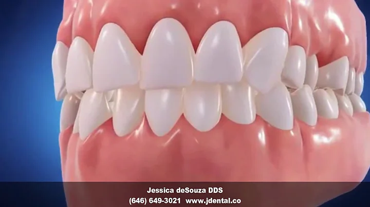 Invisalign Dentist New York NY