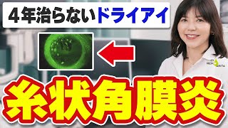 Painful! Vision loss and risk if left untreated! Causes and treatment of filamentary keratitis