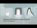 PASS THE CDCA - All Ceramic Anterior Crown Preparation | My Dental Key