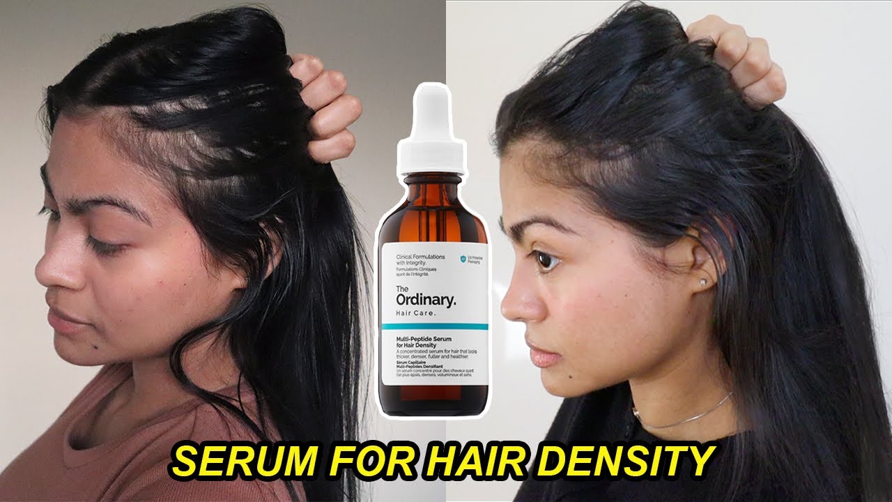 I tried The Ordinary Serum for Hair Density for 4 months & THIS HAPPENED! |  Before and after results - thptnganamst.edu.vn