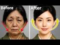 Japanese Just 15 Min A Day No Needles No Surgery 2025 Japanese Just 15 Min A Day No Needles No Surgery 2025