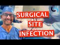 Surgical Site Infections (SSI) Made Easy - A Surgeon's Guide