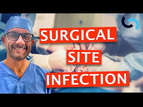 Surgical Site Infections (SSI) Made Easy - A Surgeon&rsquo;s Guide